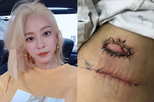 배우 한예슬이 20일 자신의 SNS를 통해 수술 사실을 공개했다. <한예슬 인스타그램 캡처>